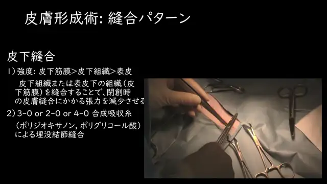 軟部組織外科学_0612